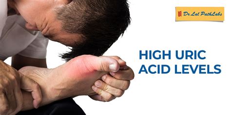 causes of low uric acid|what causes high uric acid levels.